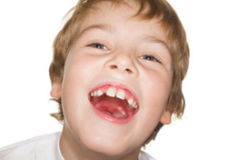 牙齒排列整齊不缺牙 遠離牙周病風險